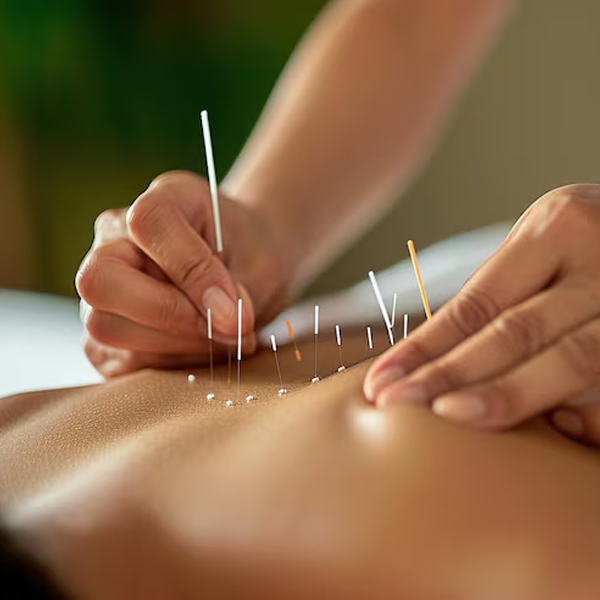 medico-acupuntura-rio-de-janeiro-medicina-endocanabinoide-chamada2